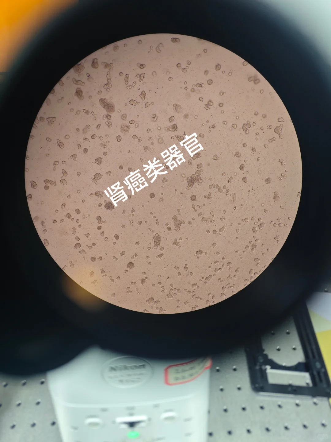 肾癌类器官明场图