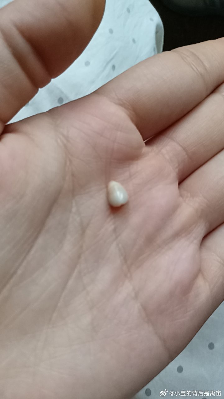 我真不行了去青岛掉了一颗牙 