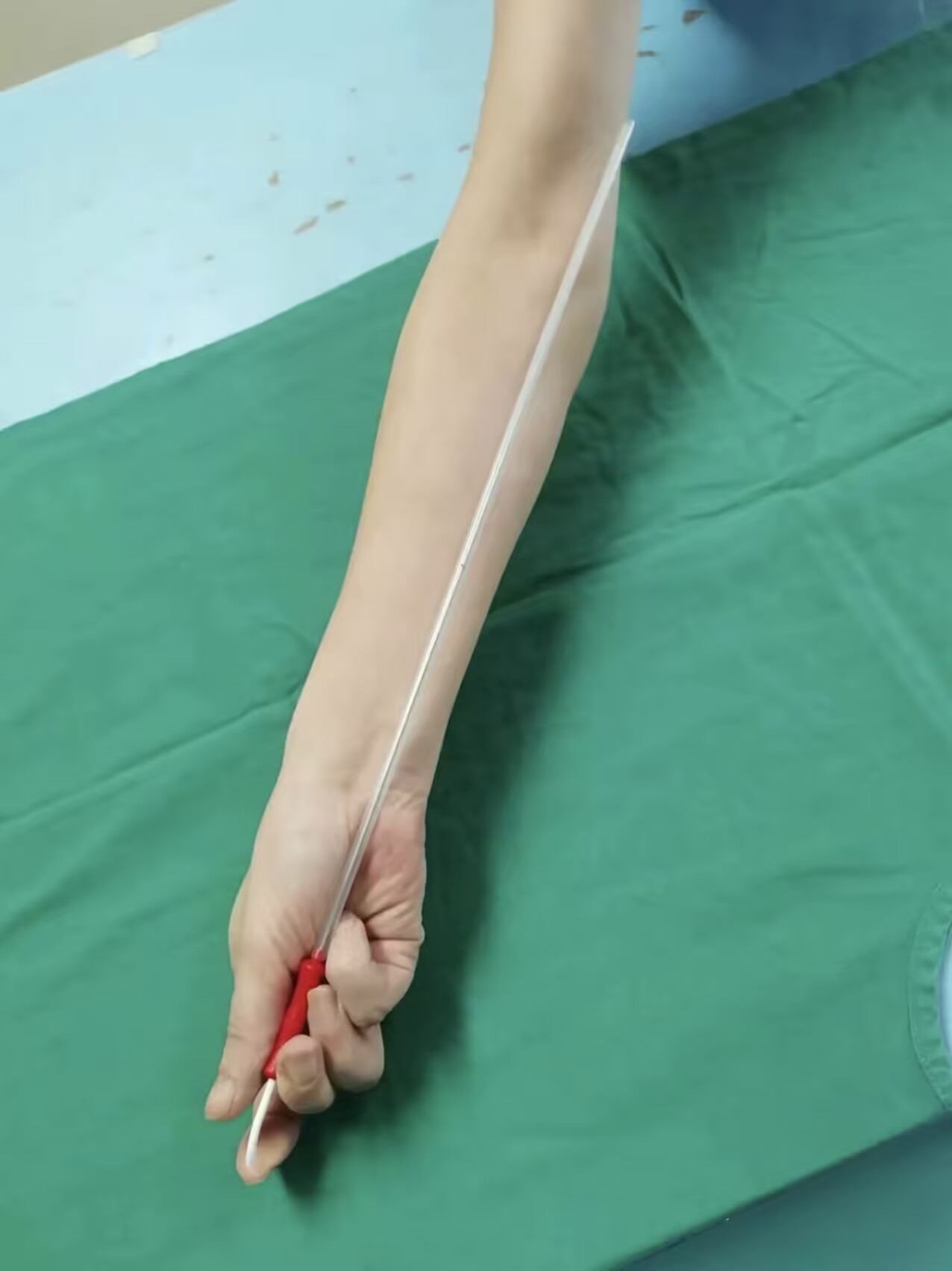 我天，刚知道取卵针有35-40cm，直接从手腕怼到胳膊肘……光看图我腿都软了，试