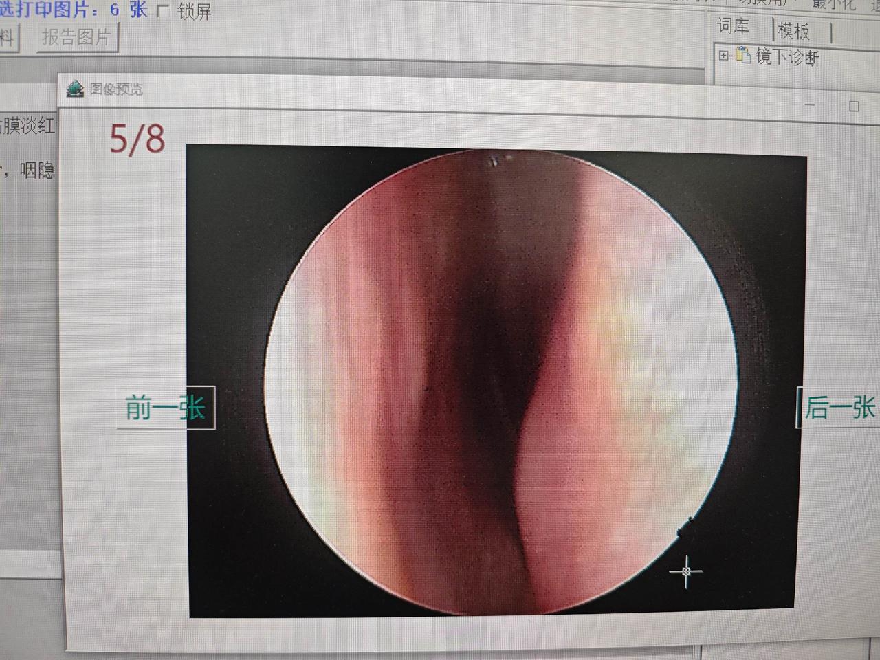 鼻出血患儿，血常规检查结果异常

最近天气炎热，鼻出血的小朋友也越来越多了。家长