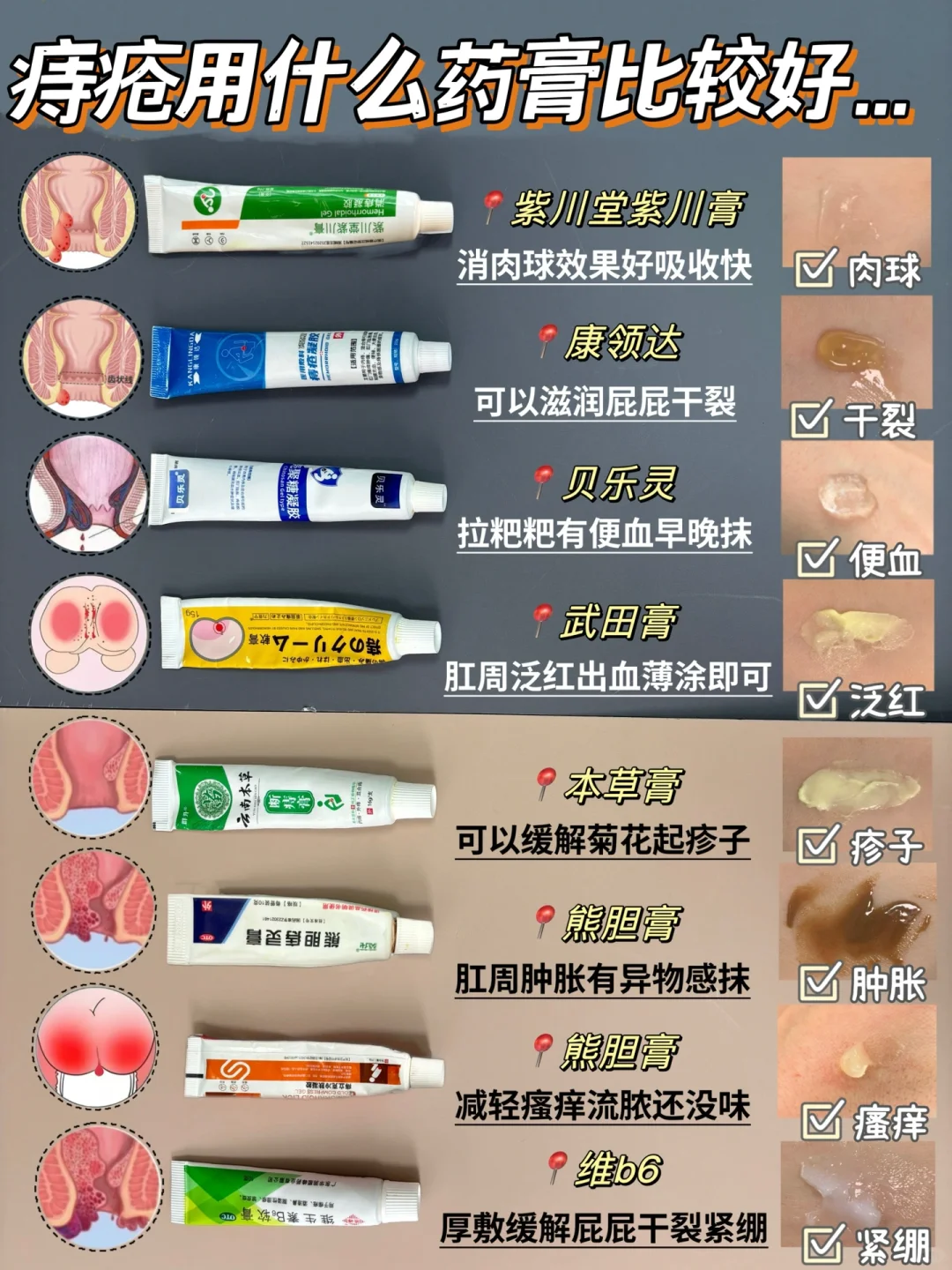 妥妥拿捏！痔疮用什么药膏好？看完不踩坑