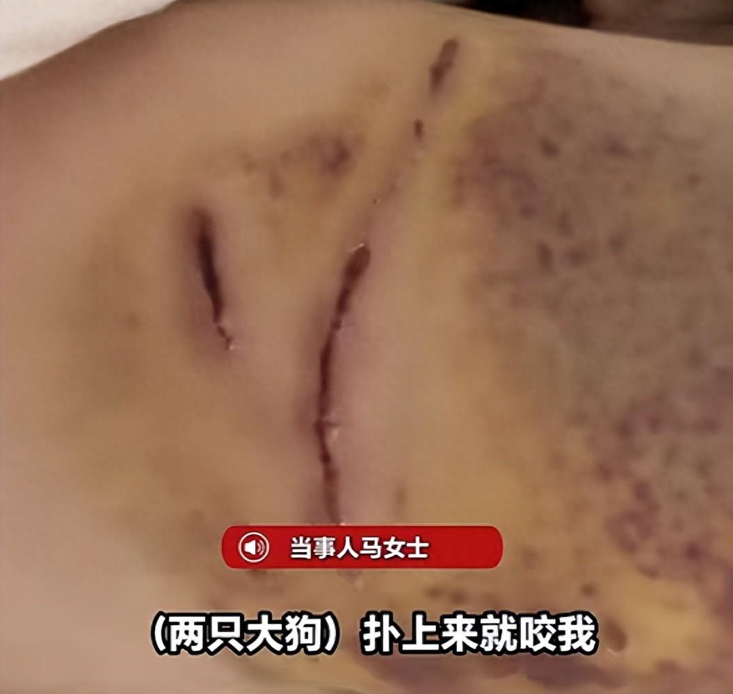 杭州萧山的马女士6月14日那天，她牵着自家小狗在停车场行走，突然冲过来两只未拴绳
