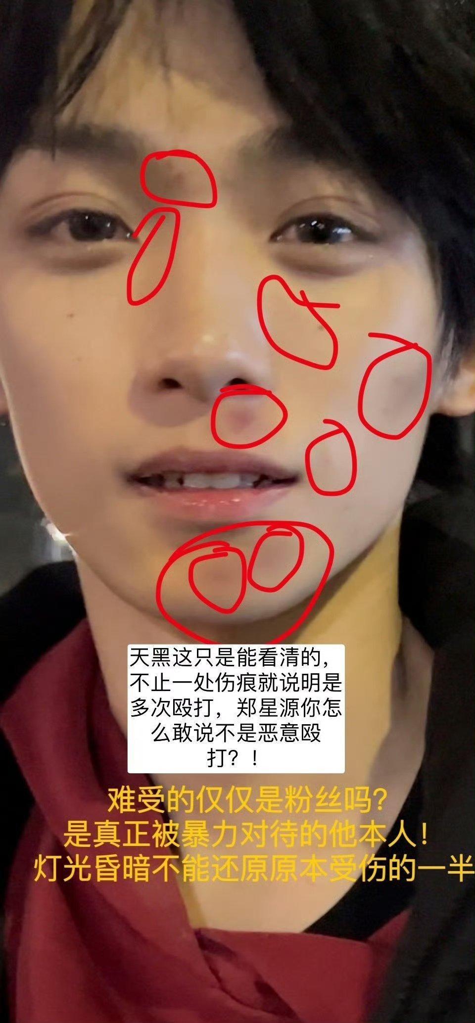 梓渝没惹，来看澄清，梓渝清清白白不要共沉沦梓渝 女朋友 ​​​
