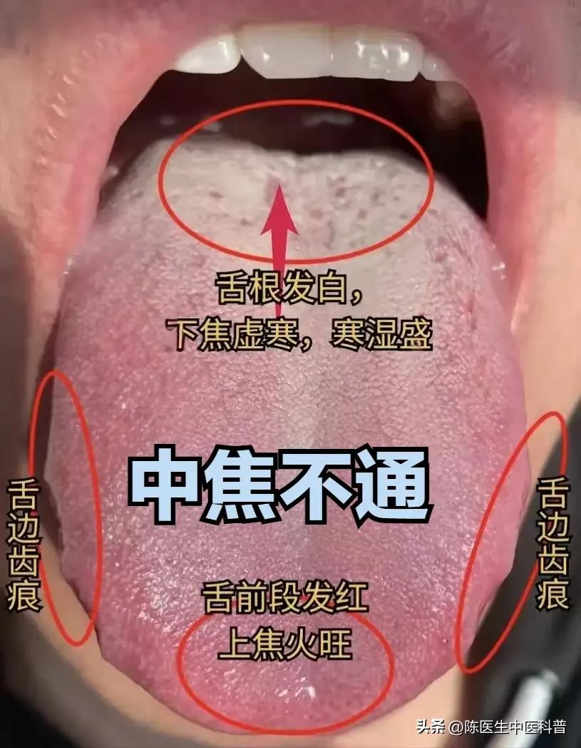 上有想法下没办法？中焦不通才是根！打通中焦，阳气自然通到下焦✨
 
我是中医陈大