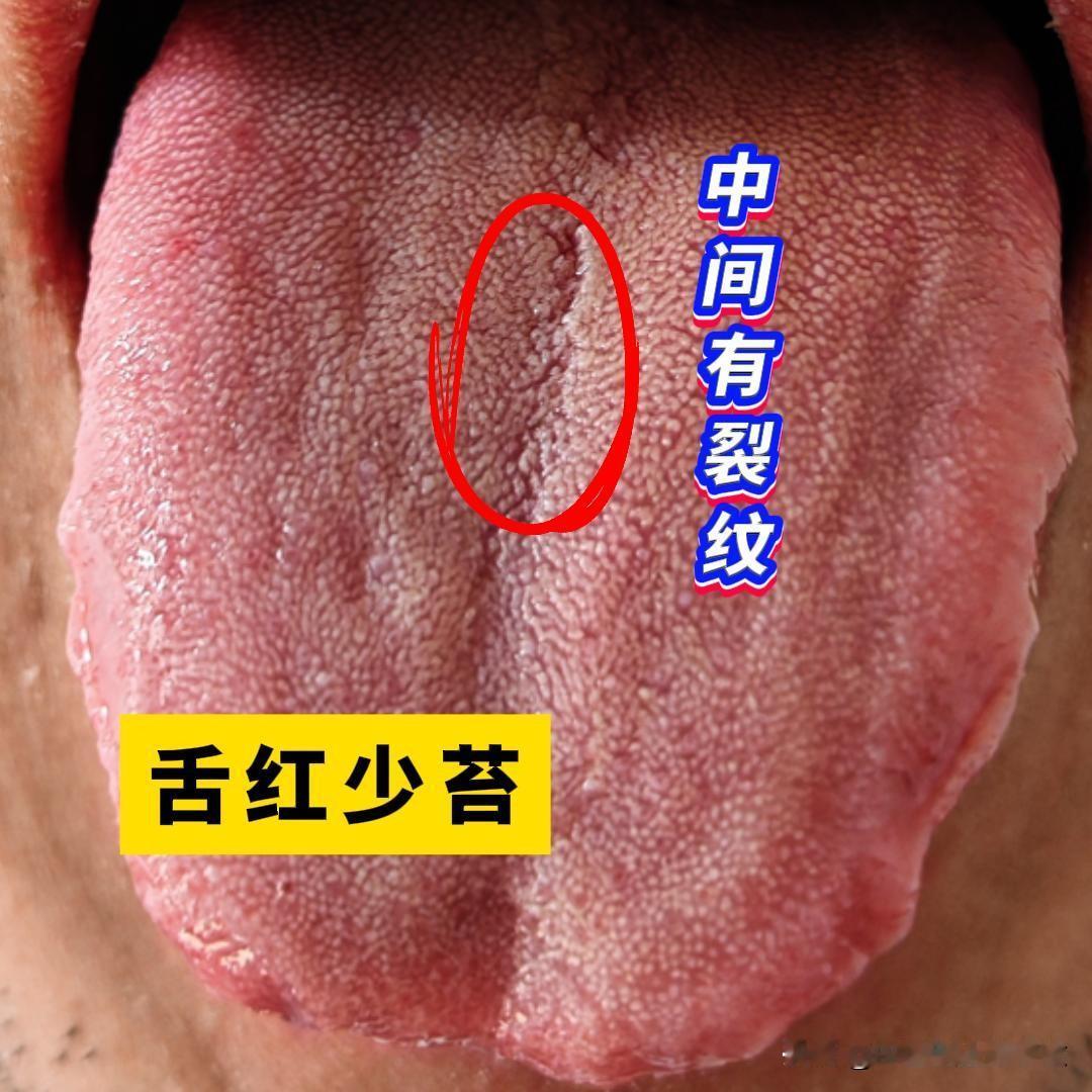 这大哥，才刚31岁，时间不到1分钟，你这也太夸张吧[狗头][狗头][狗头]
主诉