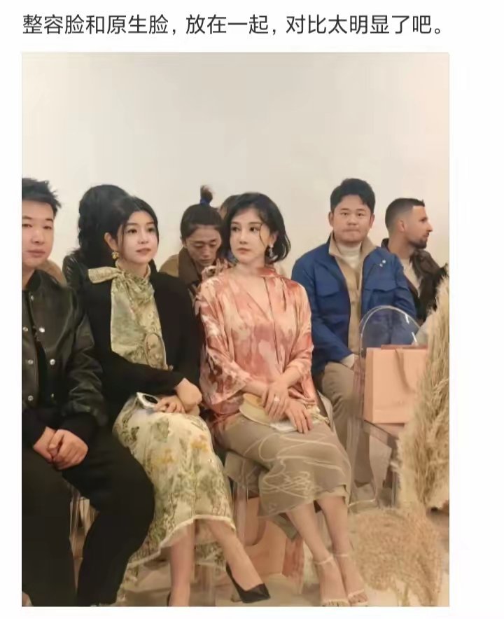 zr脸和原生脸放在一起，对比也太明显了 