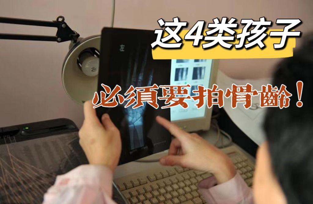 骨龄非拍不可？这4类孩子，必须要拍！
 
骨龄就是骨骼的年龄，因为骨的发育贯穿了