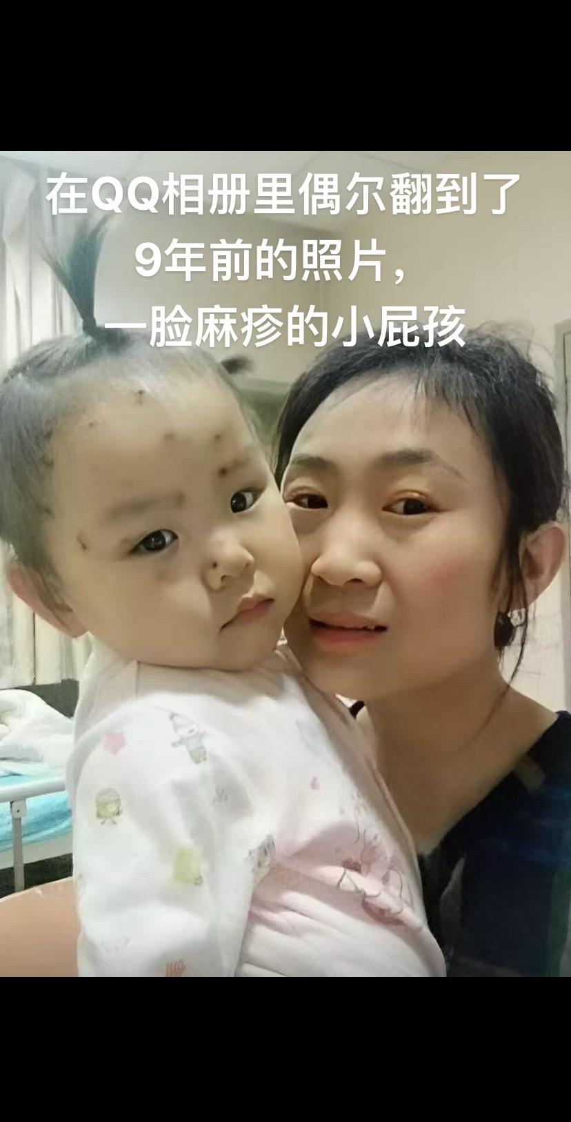 一脸麻疹的小屁孩转眼都12岁了！