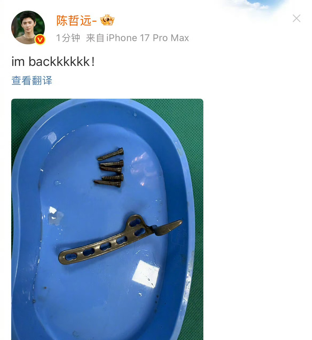 陈哲远晒手术取出的钢钉看着好心疼！从锁骨摔伤到做手术到取钢钉，每一步都对粉丝汇报