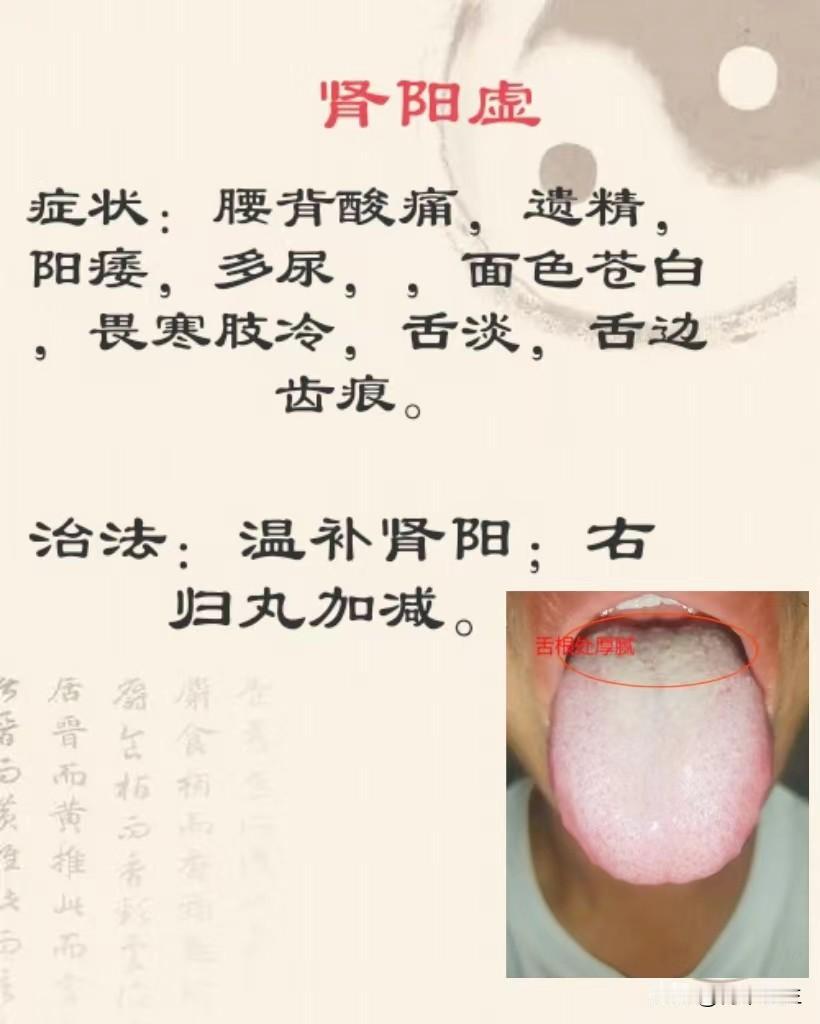 三种阳虚大不同，调理方法别弄错
肾阳虚小腿凉，脾阳虚肚子凉，心阳虚后背凉。三个辩