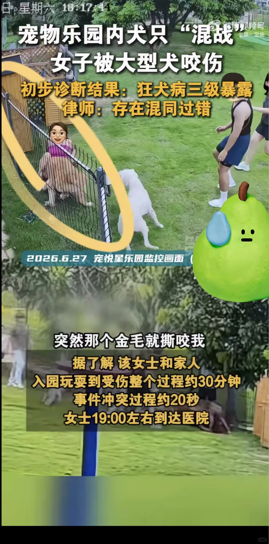 女子遭大狗撕咬20秒狂犬病三级暴露狂犬病三级暴露是最高风险等级，意味着伤口已贯穿