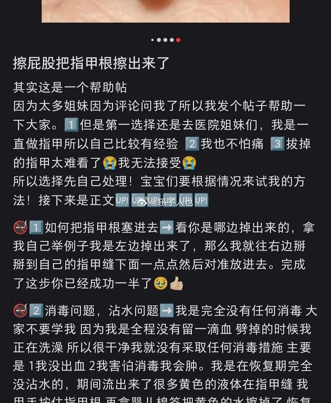 擦屁股把美甲弄断 