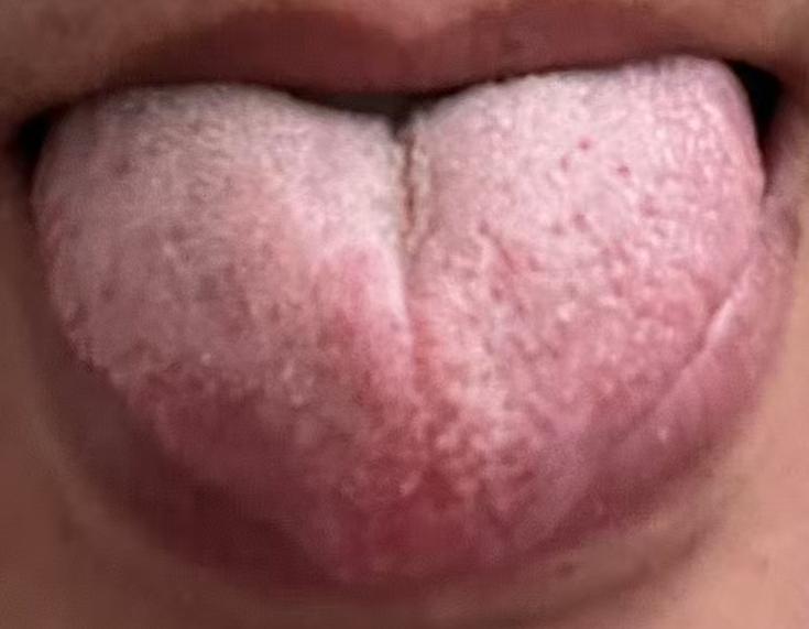 中年阳气亏虚、固摄不足？中医温养命门，固本培元强体质





很多朋友到了中年