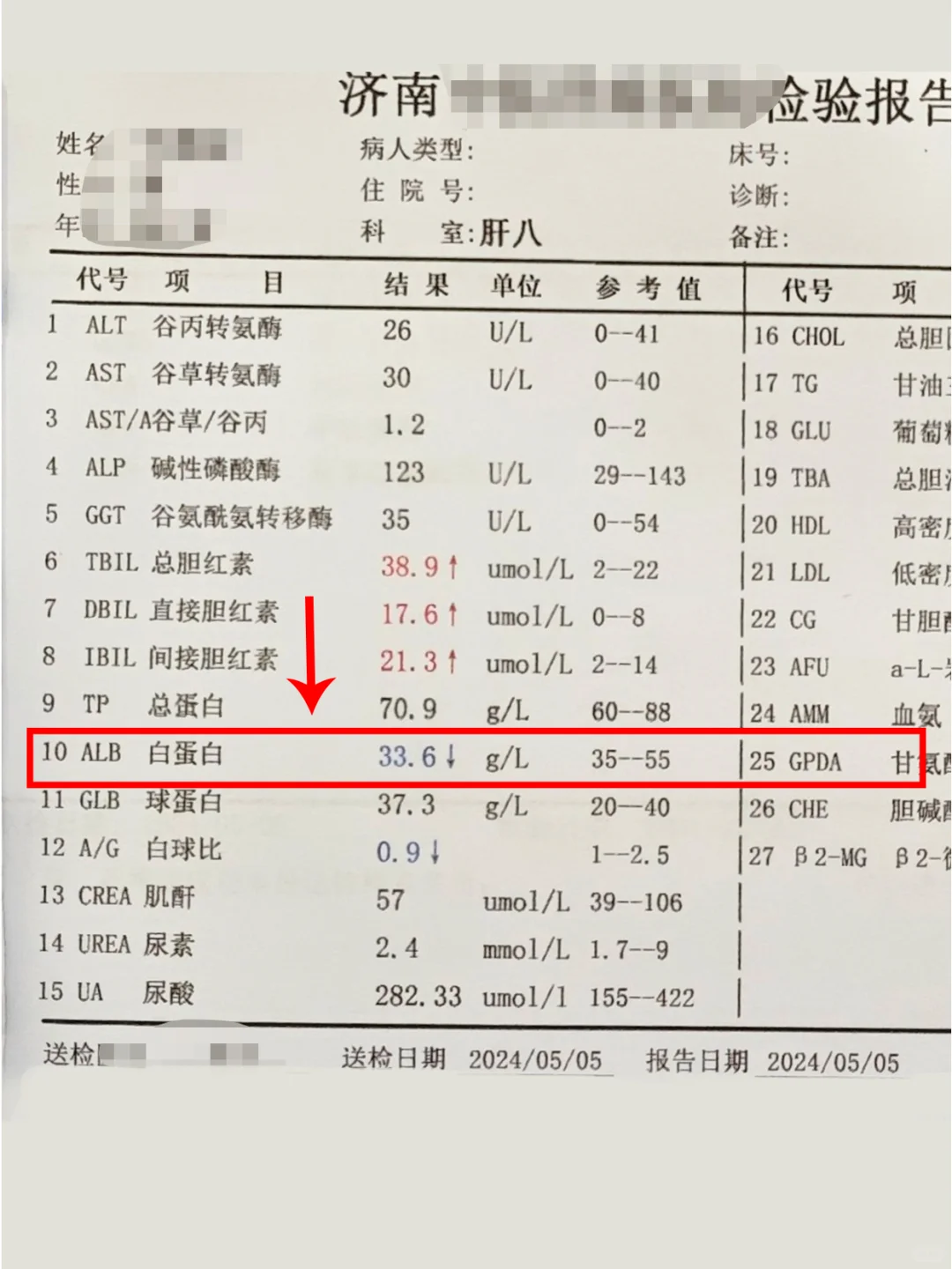 别拖！肝功能上这个数值低于30，警惕肝硬化