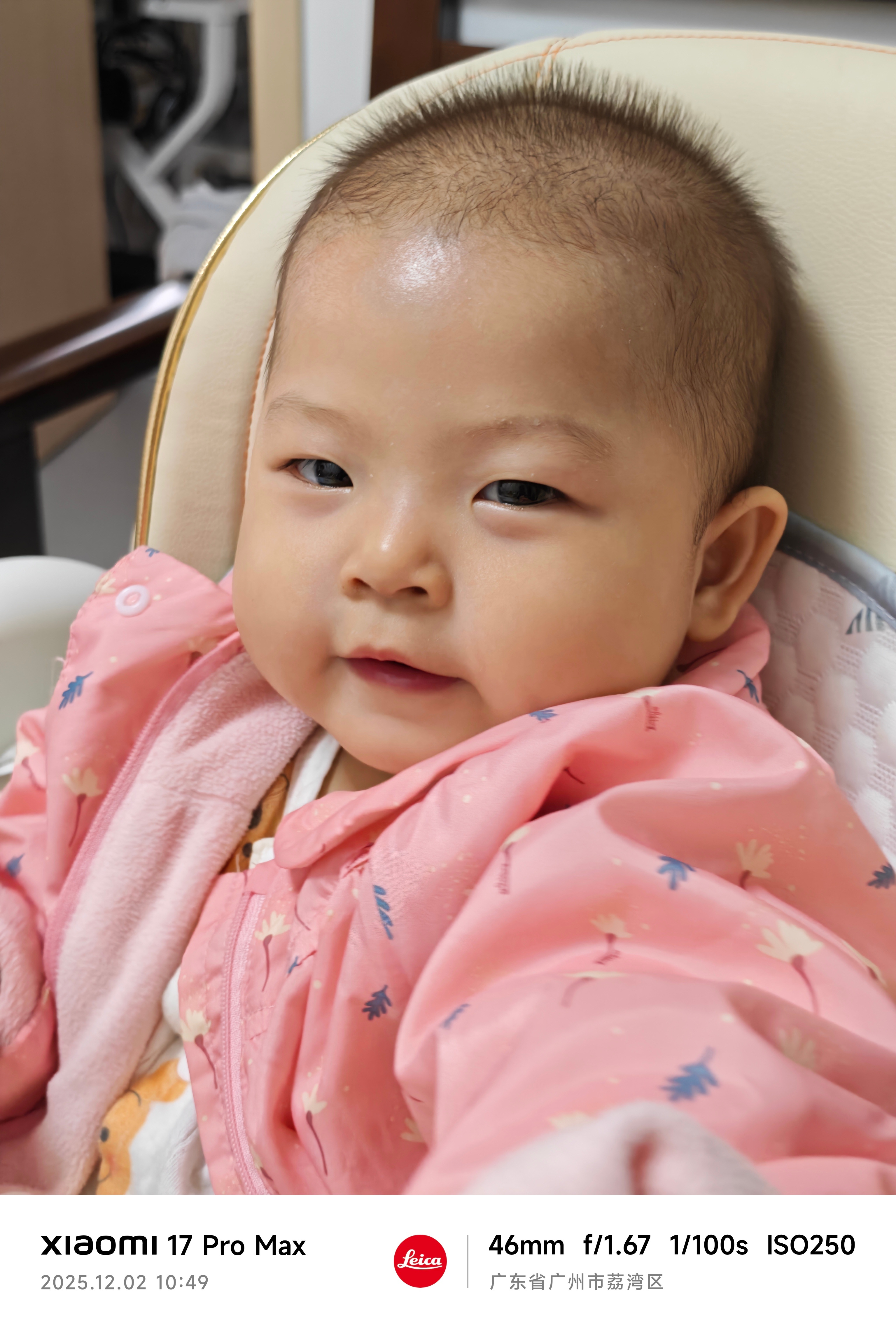 磕到头了，紫了一块。