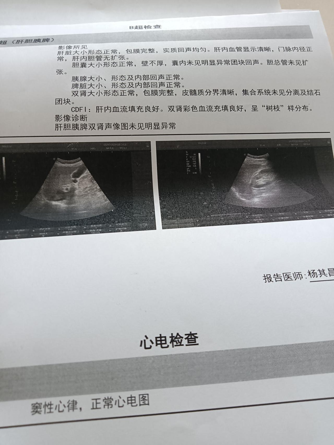 友友们，保健方面，《黄帝内经》有云：“圣人不治已病治未病。”这观点实在精妙！大家