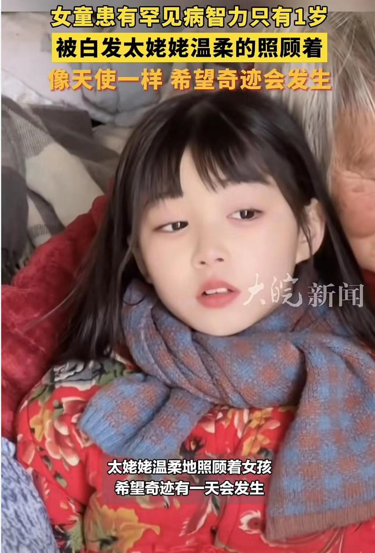 漂亮女童患罕见病智力仅1岁，网友：要提防村里老光棍
最近媒体们报道了安徽一位漂亮