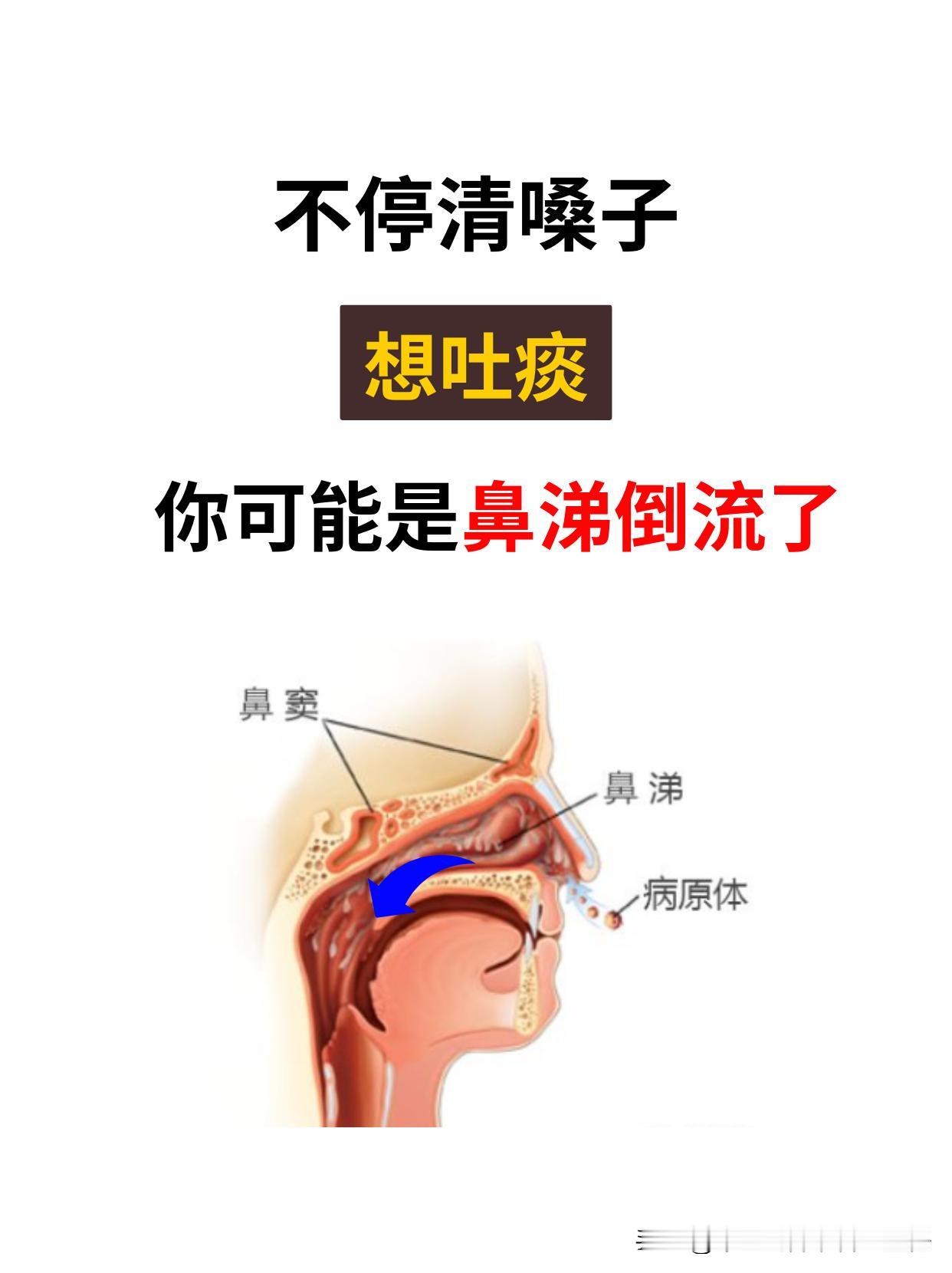 不停清嗓子，想吐痰，你可能是鼻涕倒流。

上周有位30来岁打扮讲究的女士来看鼻涕