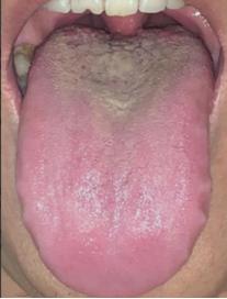 这舌头，你可就别瞎折腾了，能力差的没眼看！
患者男，主诉：肾虚，时间短，但一到晚