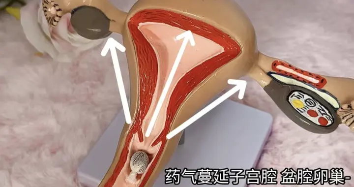 号称能排子宫毒素、月经残留，“清宫丸”涉嫌触碰多项法规红线