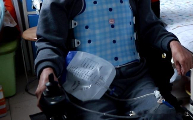 脊髓损伤大小便恢复的过程是怎么样的
 
1、对于损伤程度较轻的脊髓损伤，如脊髓震