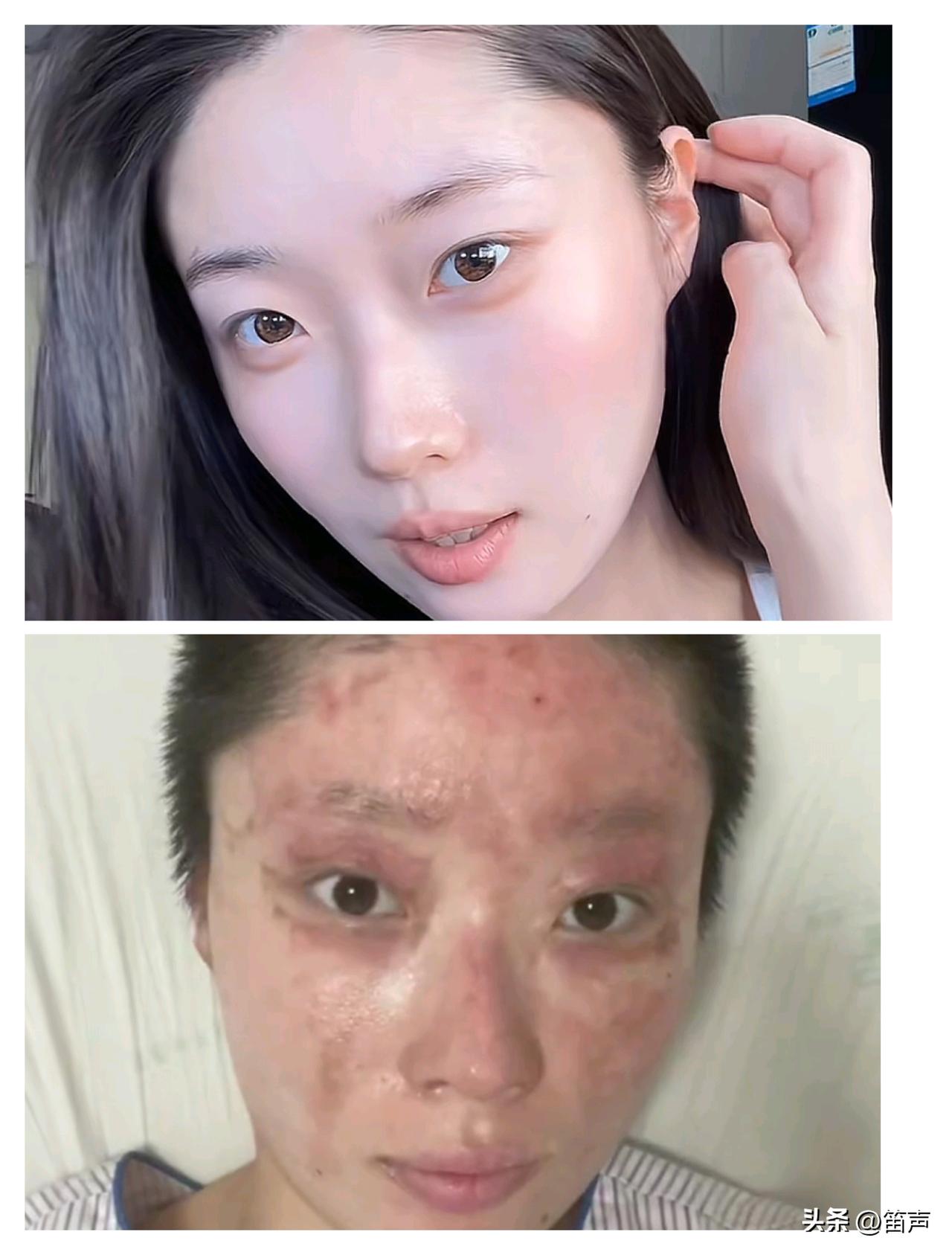 明天和意外真不知道哪个先来
刷到一个抖音博主，叫童谣的98年小姑娘，因家里的液化