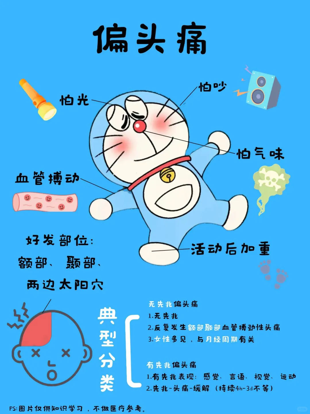 医学生笔记——偏头痛（附缓解方法）