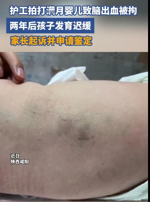 陕西咸阳警方通报了一起恶劣的伤害案件。一名仅仅出生31天的新生男婴，本应在月子中