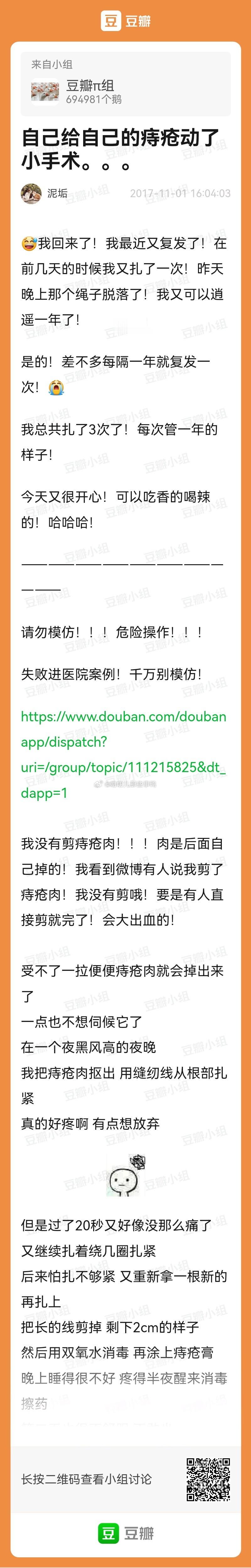 9年前的帖子现在看依旧是会被这位帖主惊到，她把她自己的痔疮扎没了！！以及不要轻易