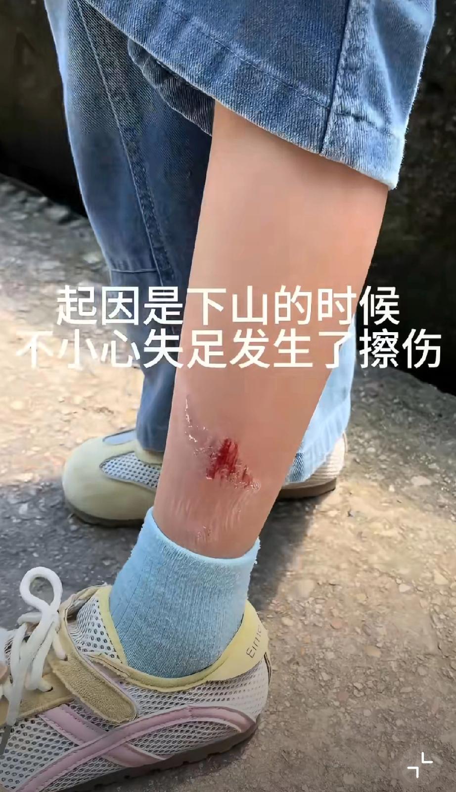 孩子下山擦伤，景区工作人员好心拿碘伏热心帮忙，
没想到女子转头就拍视频举报大叔抽