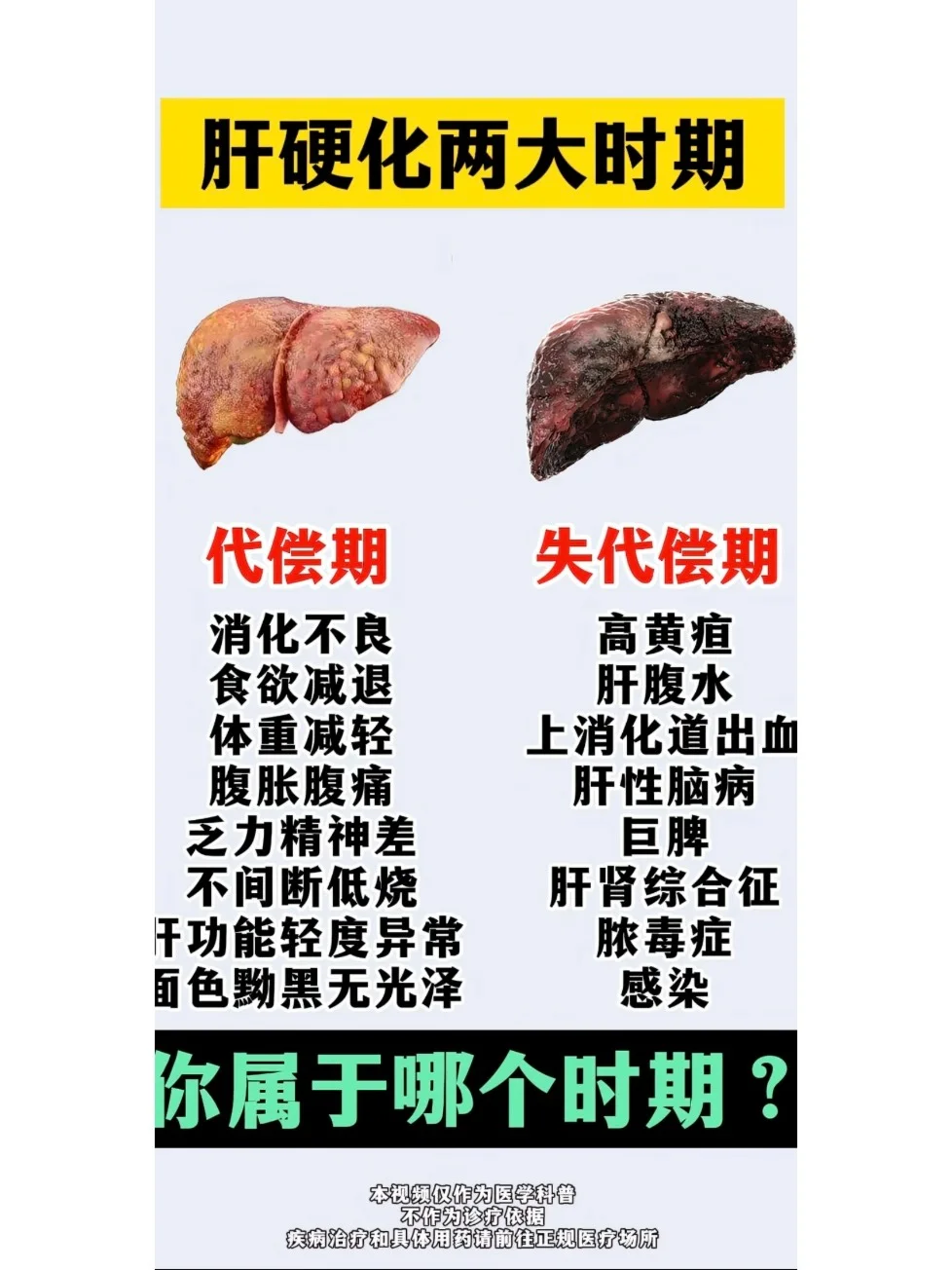 肝硬化两大时期，你属于哪个时期？ 