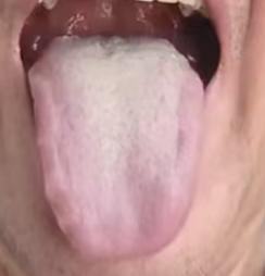 中年男士状态下滑？根源多是心肾阳气不足






很多朋友到了中年就出现了见色