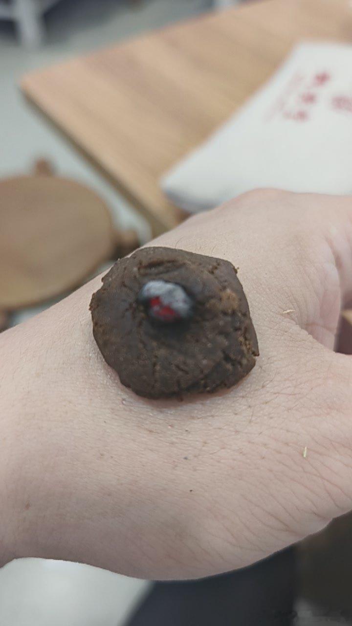 药灸合谷穴预防感冒中医艾灸 杭州