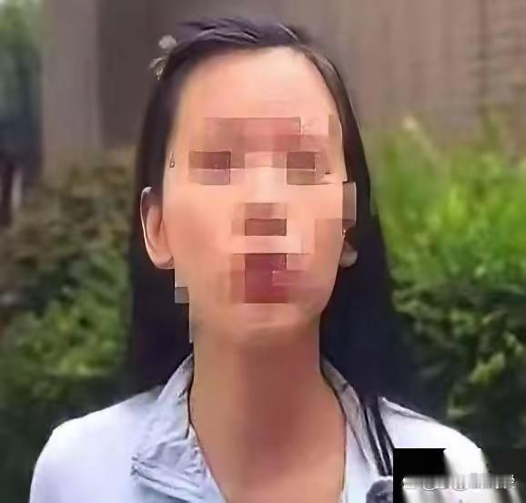 我的天呐！

   长沙鲁女士这遭遇简直刷新认知下限！
   躺上医美手术台被打