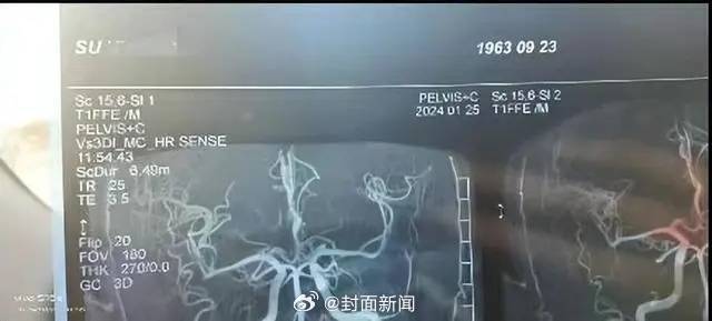 【#卫健委回应医生联手医托私收检查费#：已介入调查】近日，有网友发文称，山西省吕