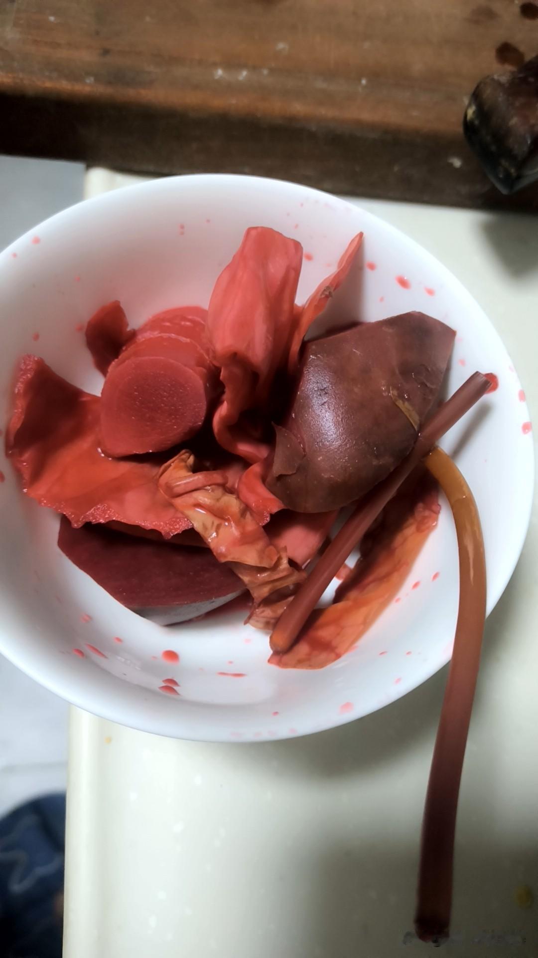 他汀药物会对身体造成伤害吗
​
​在发表于《神经学档案》上的一项关于他汀类药物使