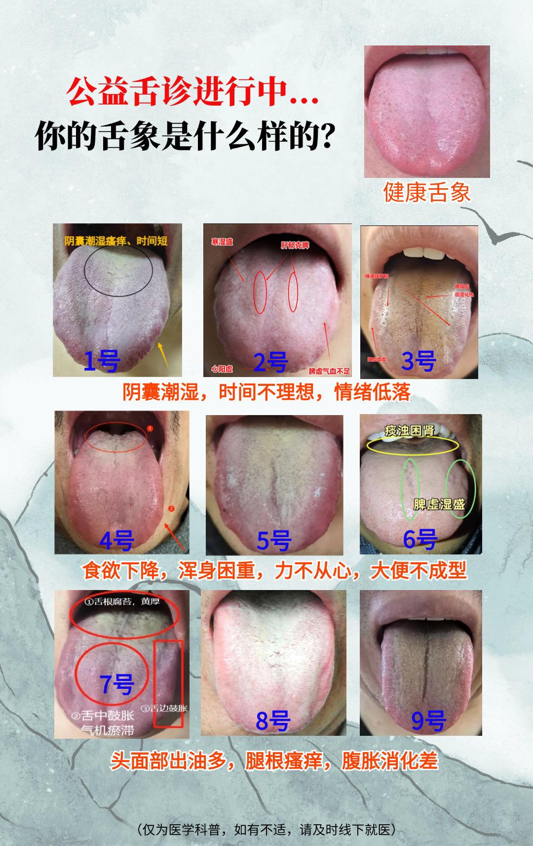 你发我来辩证分析#中医 #舌诊 #中医养生 #每天跟我涨知识 #舌象科普