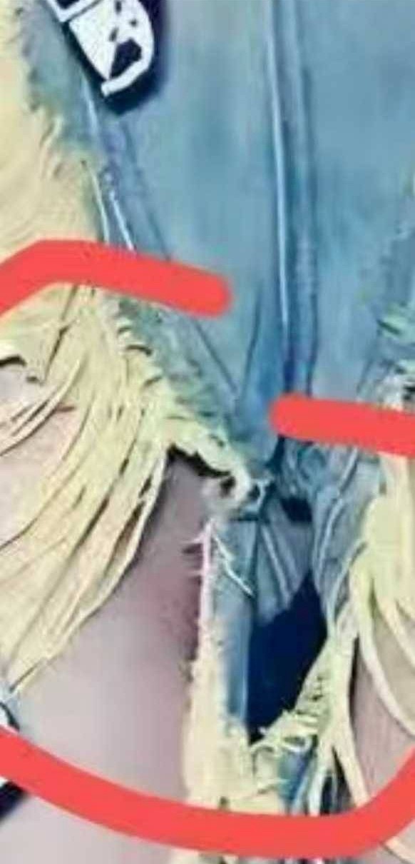 这是什么？牙印吗[流鼻血] ​​​