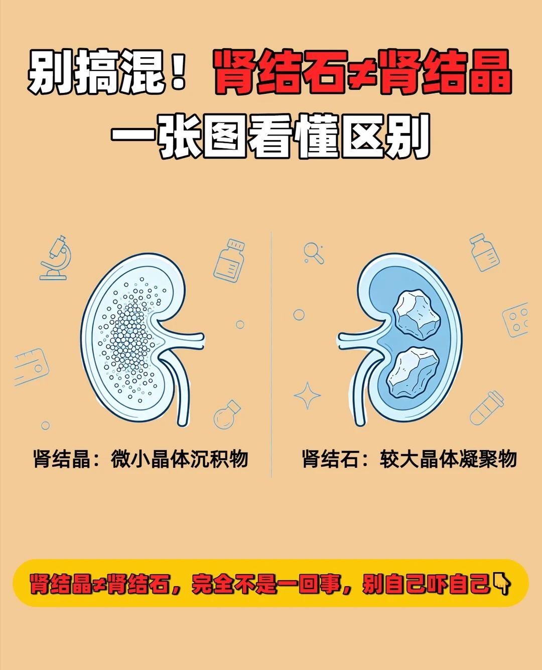 别再搞混了！肾结晶≠肾结石，一张图看懂二者区别
