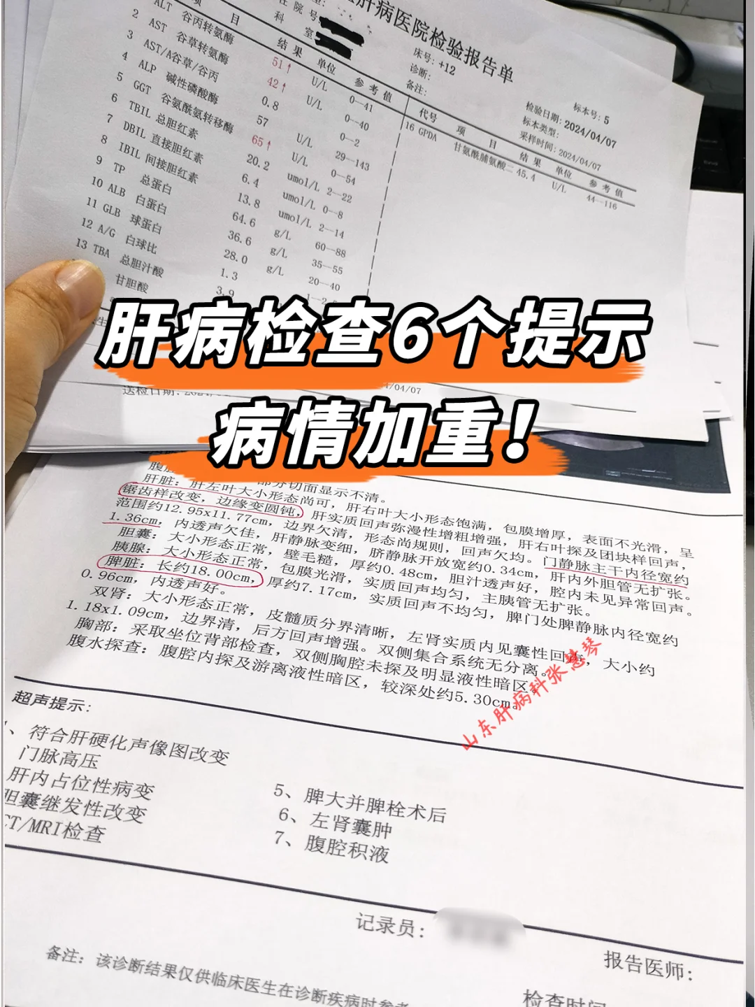 别耽误！肝病检查6个提示，病情可能加重了