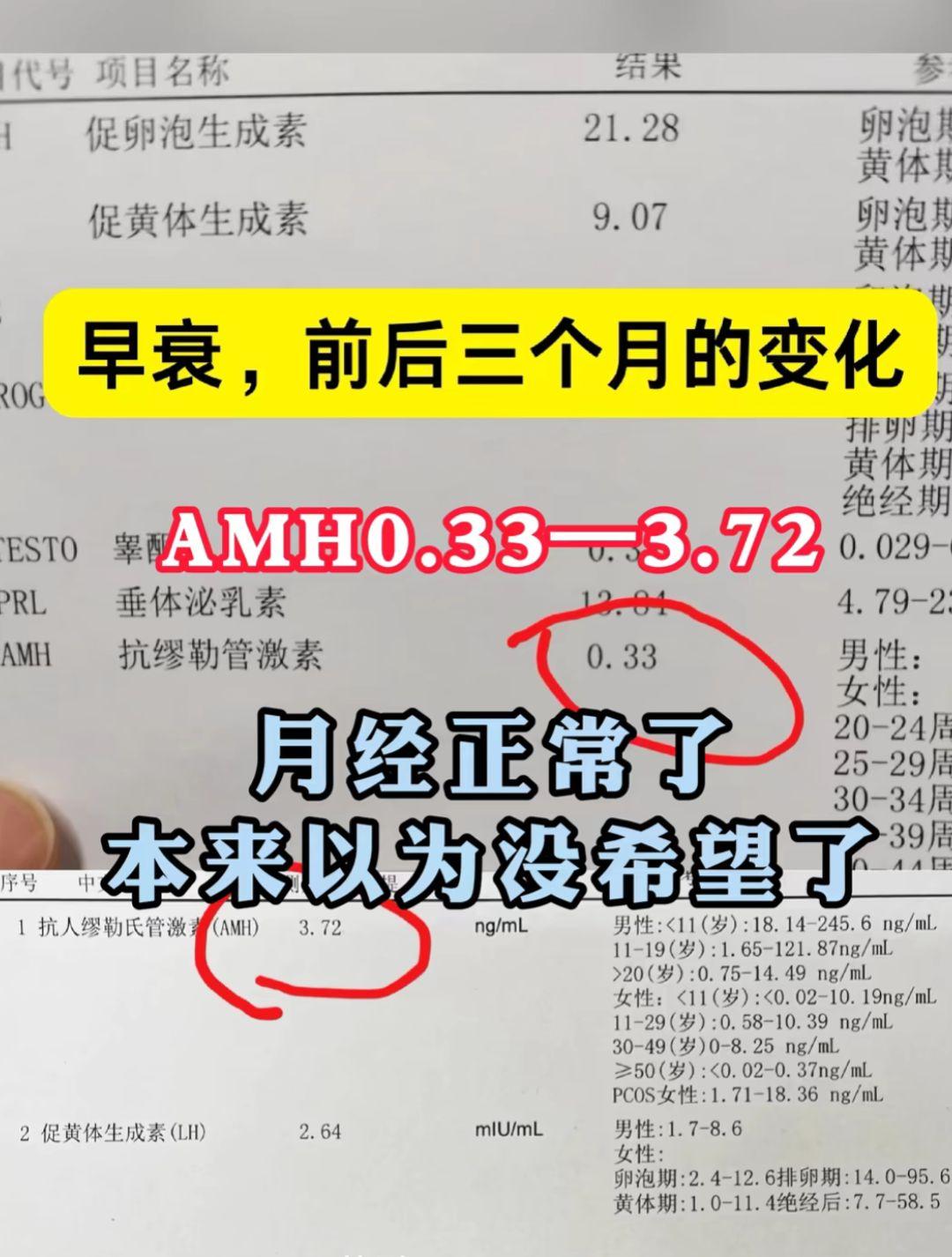 34岁的赵女士，被查出卵巢早衰，她面色晦暗、神情焦虑，自述停经半年有余...