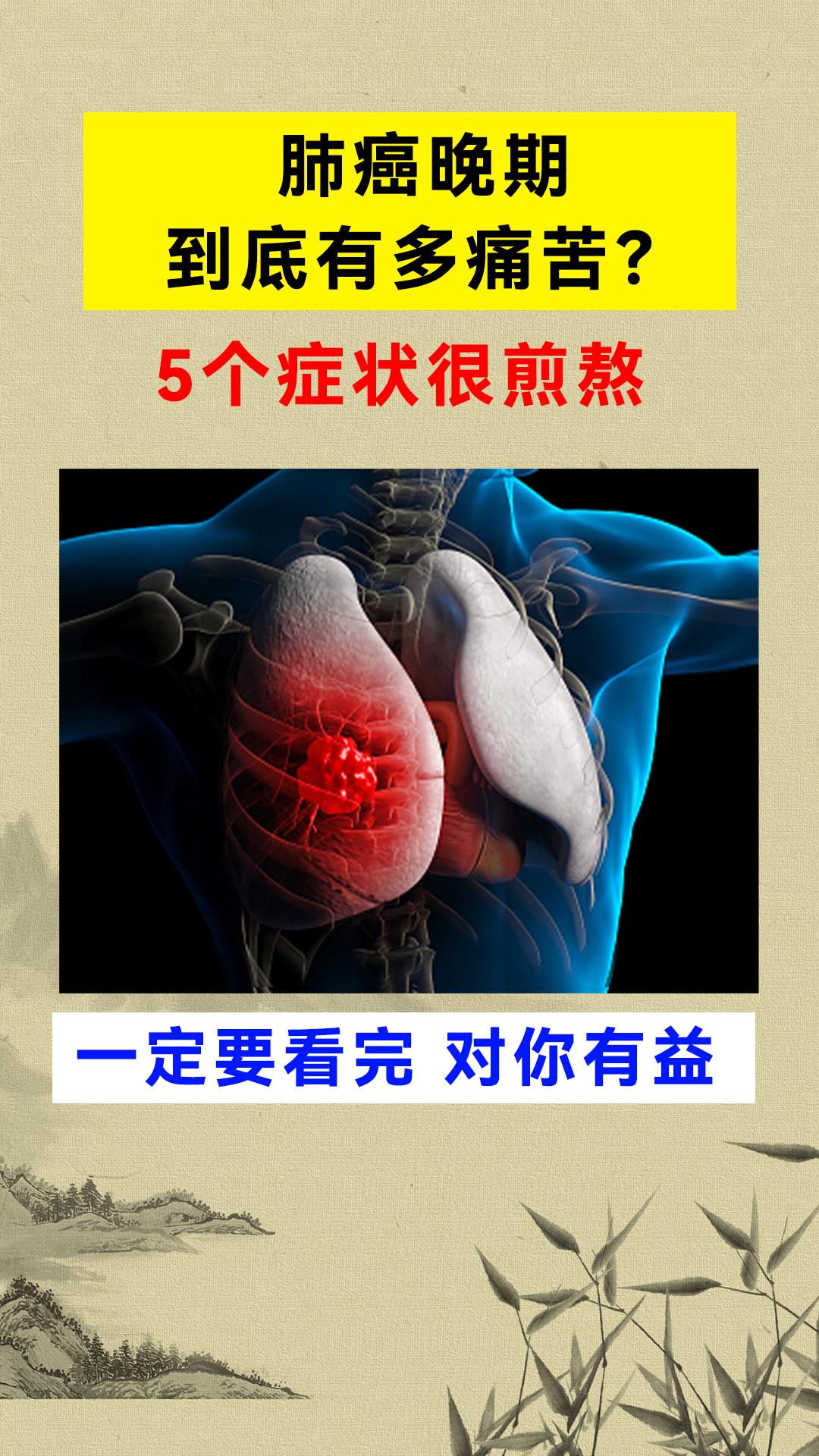 医学科普 肺癌 莫爵飞