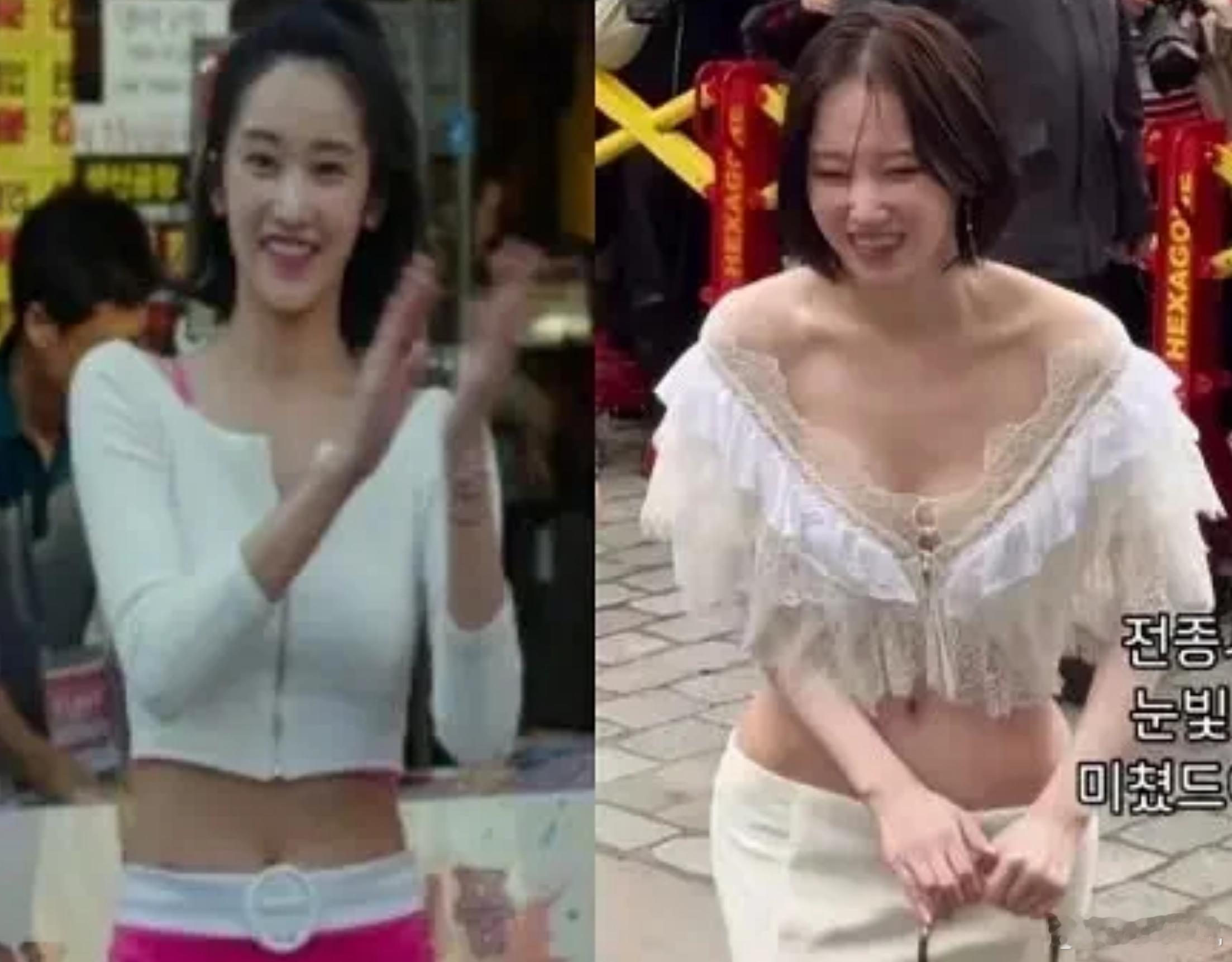 全钟瑞这个盆骨手术太明显了吧 ​​​