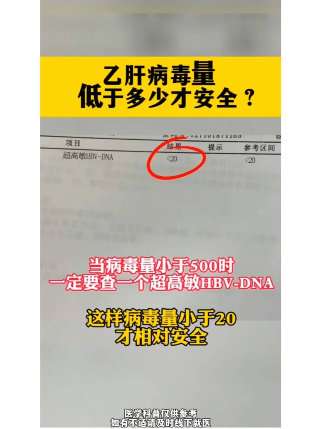 乙肝病毒量低于多少才算安全？
