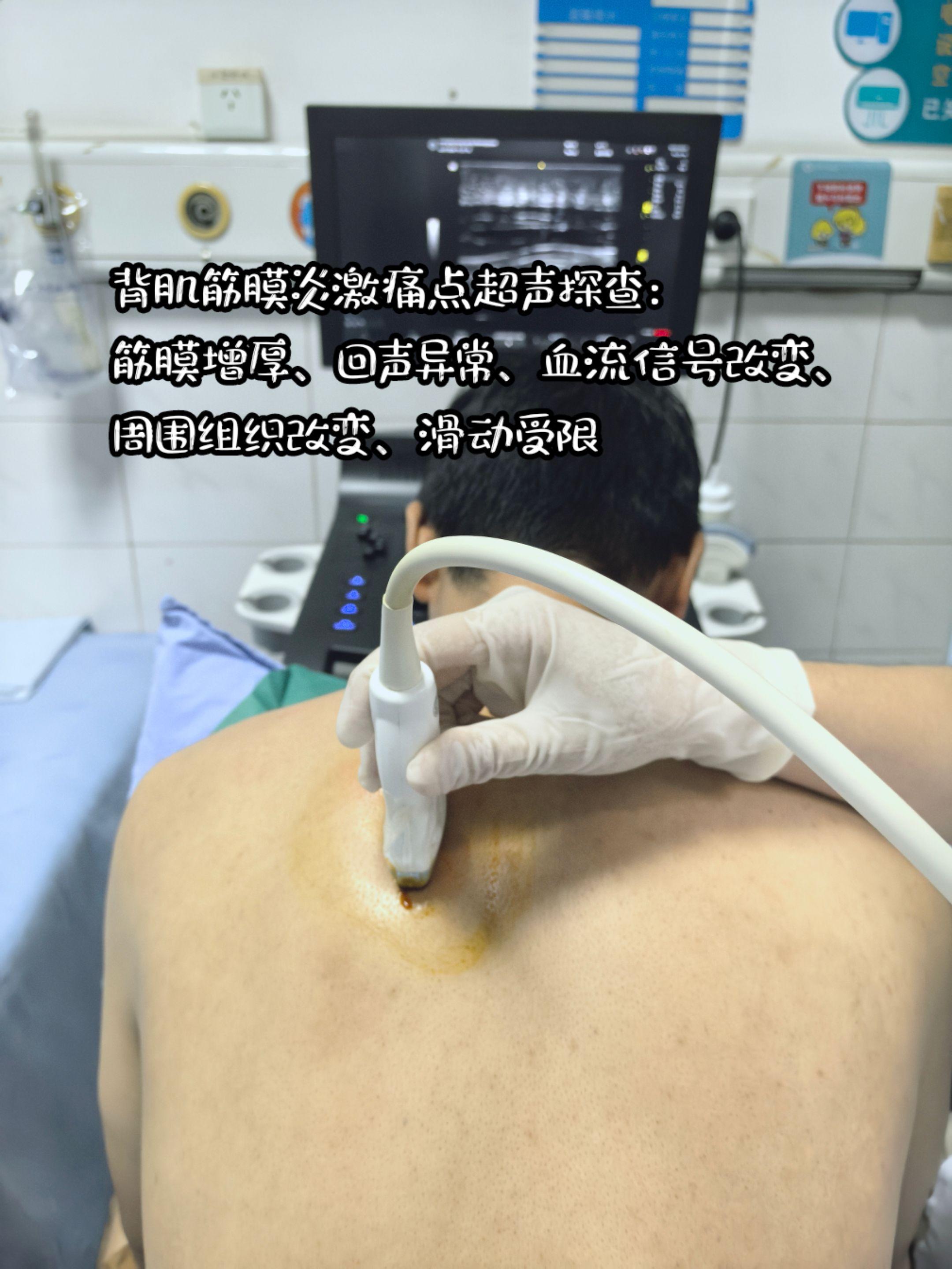 筋膜增厚 - 反复渗出机化。筋膜回声异常- 急性期炎性渗出，慢性期纤维...