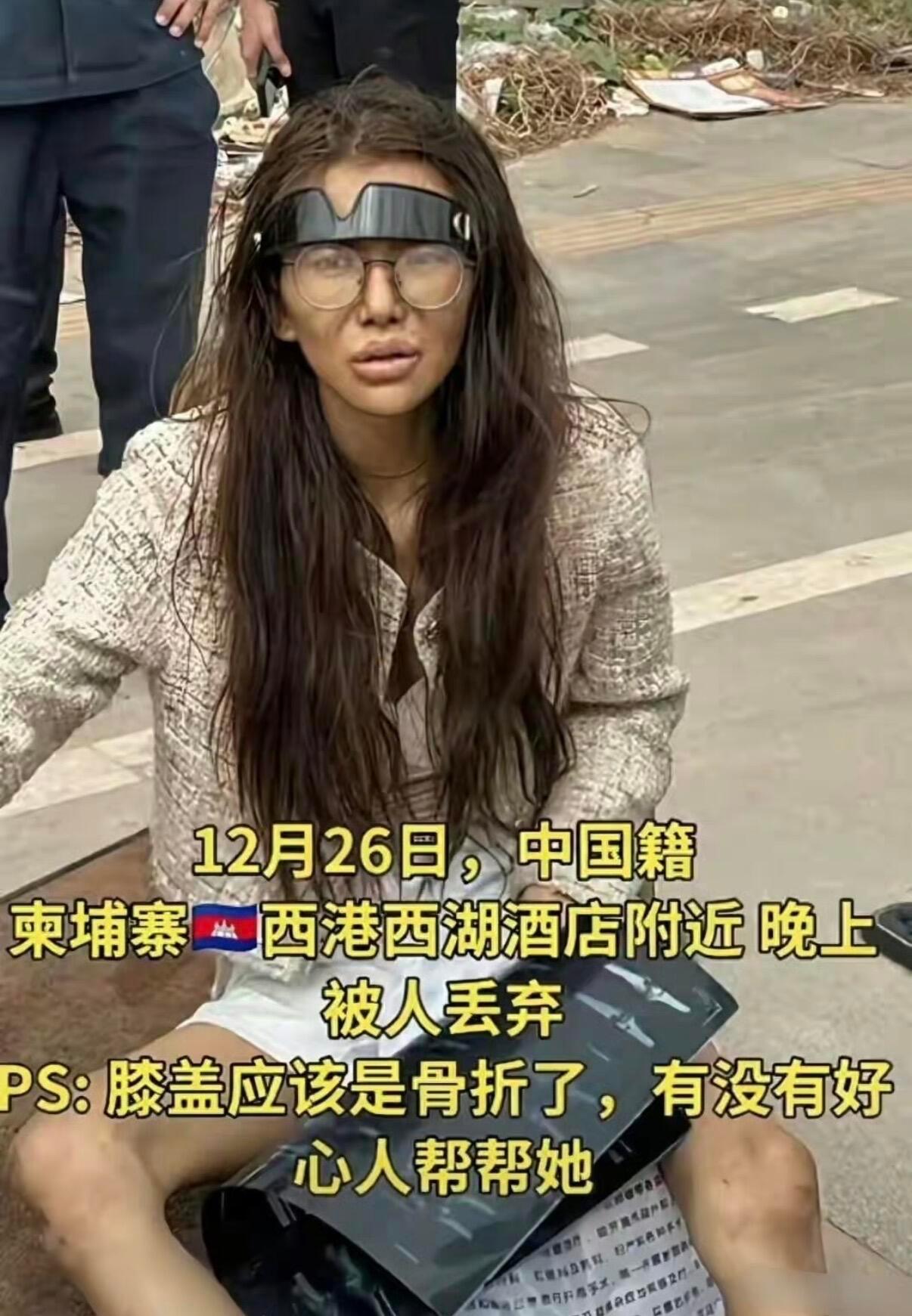 被拐卖到电诈园区的女性会经历什么大家网上已经看过很多女性被骗后有多惨了，牢记啊！