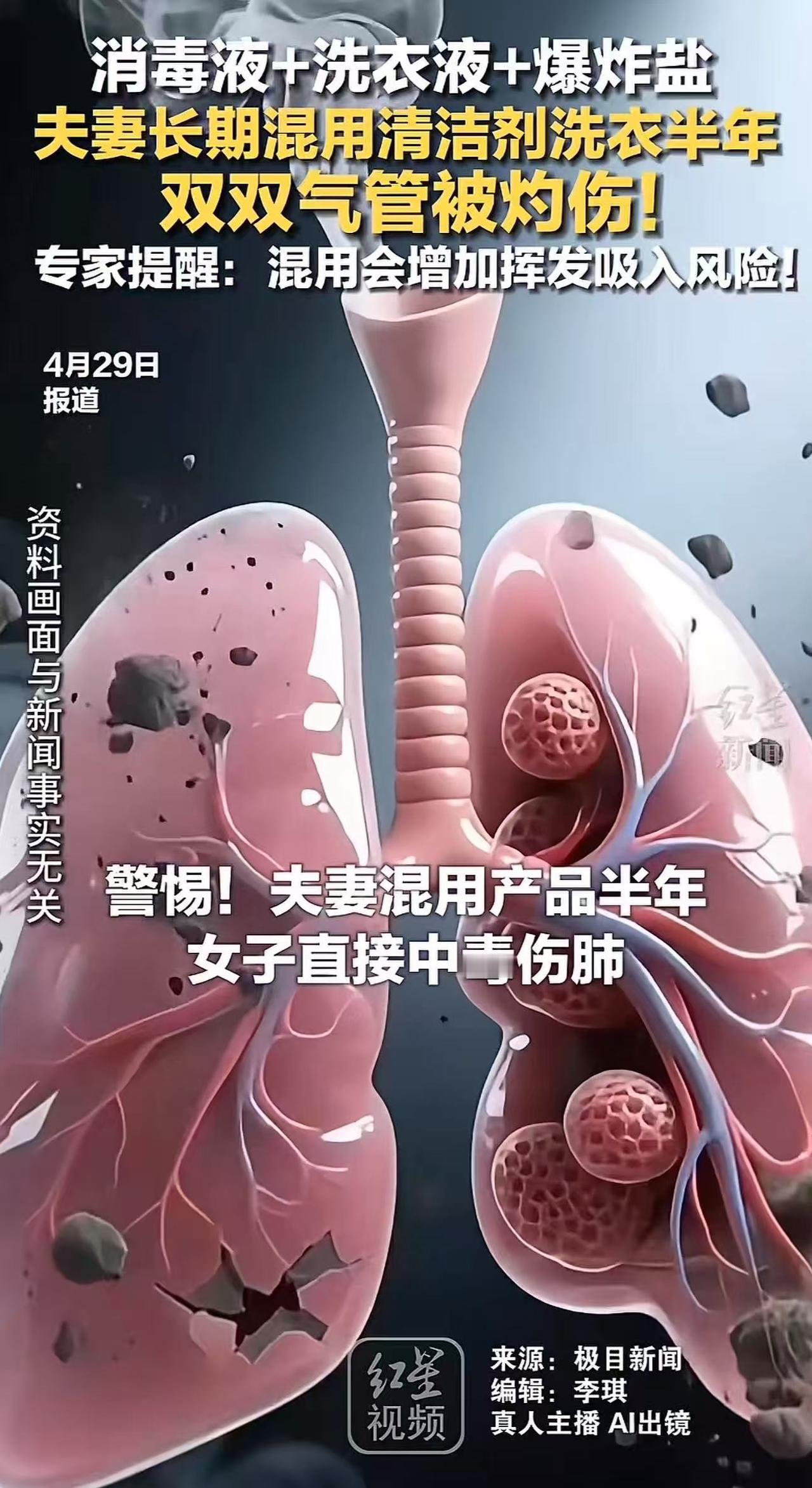 一对夫妻双双“中招”，妻子突发窒息险丧命，而祸根竟是藏在洗衣机里的“隐形杀手”！