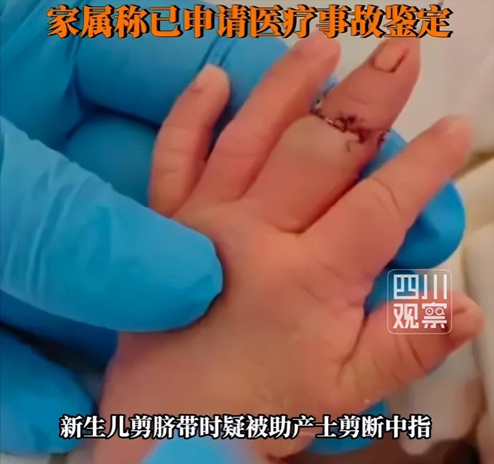 刚降临人世的小生命，本该被悉心呵护，却在医院的手术台上遭遇惊魂一刻。江苏盱眙县人