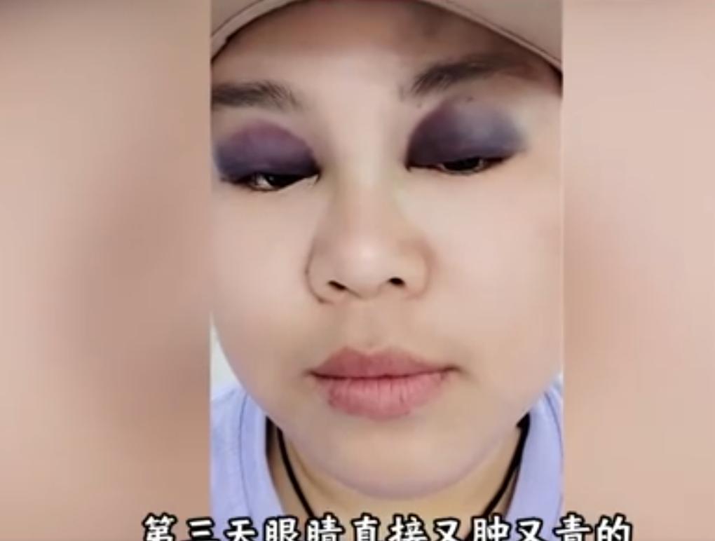 乐极生悲！广东汕头，一对夫妻在床上打闹，没成想，一时力度太大失控，女子直接撞到床