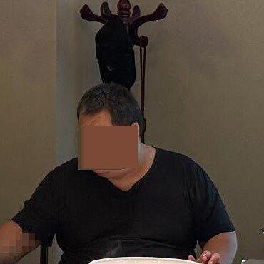 这事儿太惨了。河南一个268斤的大哥，为了减肥去做切胃手术，结果在ICU抢救五天